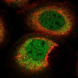THAP10 Antibody, Novus Biologicals 0.1mL; Unlabeled:Antibodies, Polyclonal